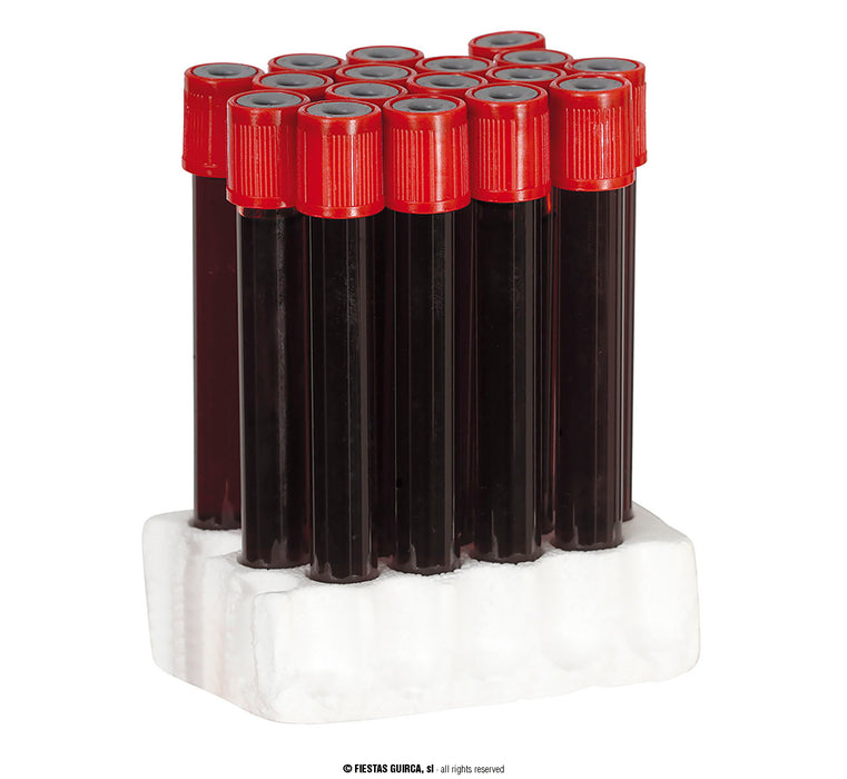 FINTA PROVETTA DI LABORATORIO CON SANGUE INFETTO